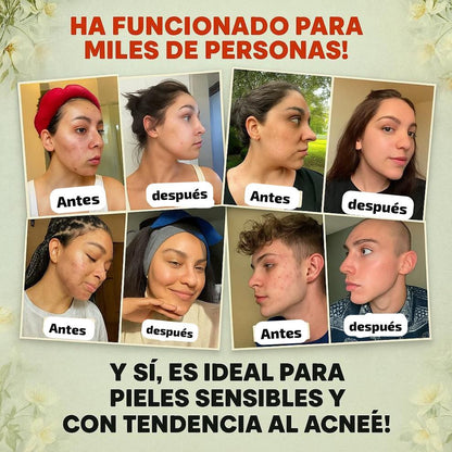 ✨ BÁLSAMO REJUVENECEDOR EVILGOODS™ – REVITALIZA TU PIEL CON RES SEBO Y MIEL DE MANUKA 100 % NATURALES 🍯